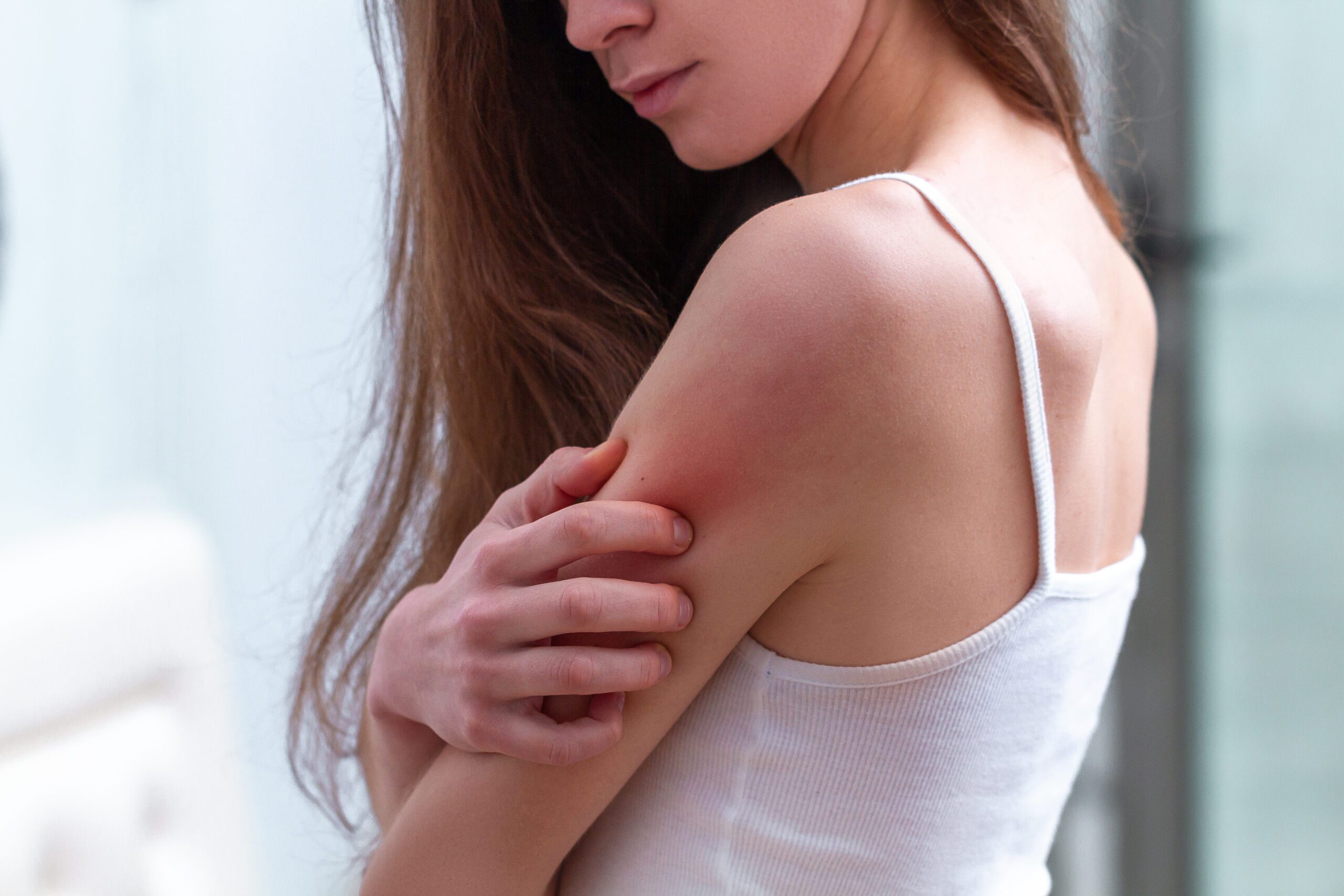 travel rashes
