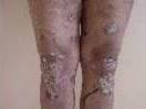 before - Birmingham Cosmetic Dermatologist - Medical Spa | Cahaba Dermatology