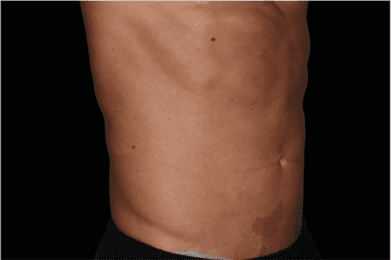 non invasive cosmetic surgery - Skin Care Clinic - Birmingham Dermatology Clinic and Medical Spa | Cahaba Dermatology