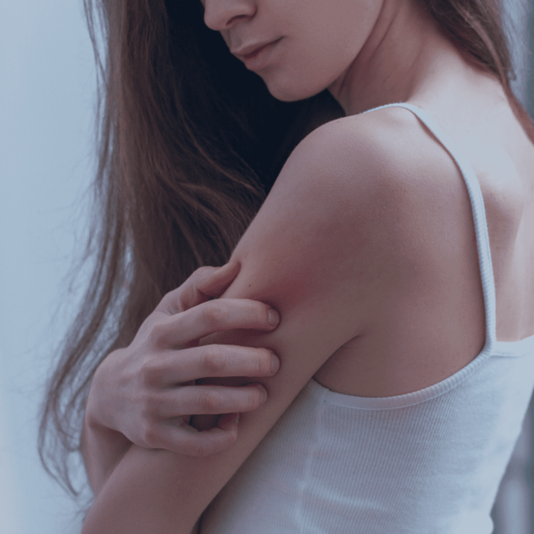 Woman with Itchy Skin | Dermatology Clinic Birmingham