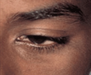 laser skin treatment - Birmingham Cosmetic Dermatologist - Medical Spa | Cahaba Dermatology