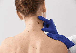 medical spa - birmingham mohs surgery